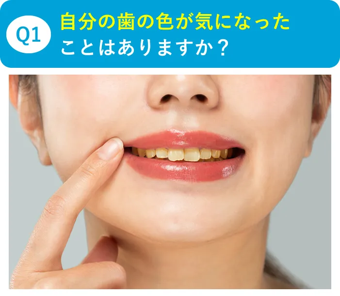 Q1自分の歯の色が気になったことはありますか？