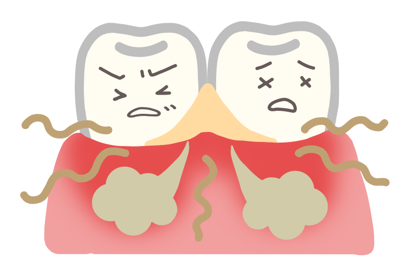 歯周病と口臭