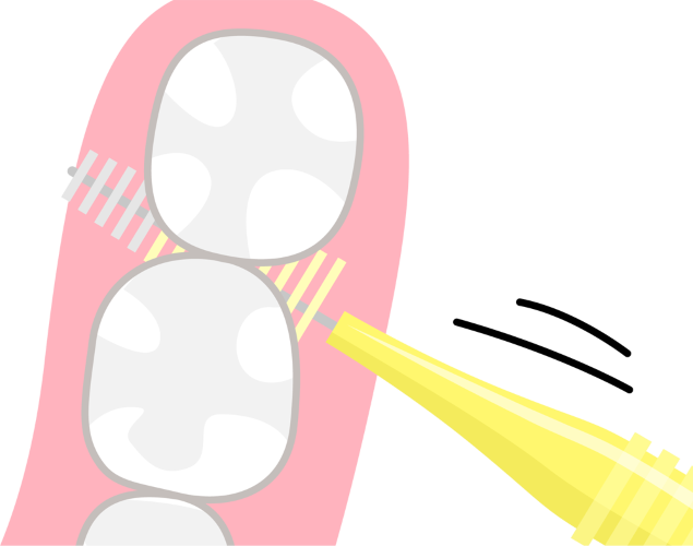 歯間ブラシのイラスト